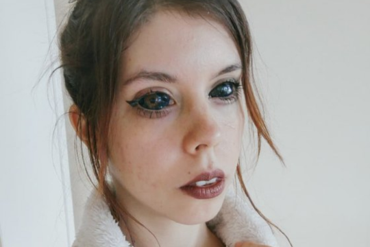 Сомнительная косметическая процедура стоила 25-летней полячке Александре Садовской зрения.