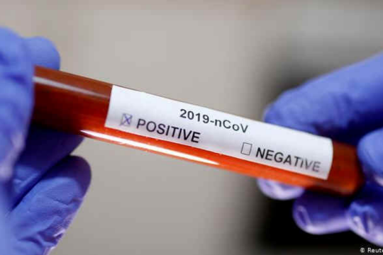 В Беларуси проведено 2 196 173 теста на коронавирус по состоянию на 17 октября