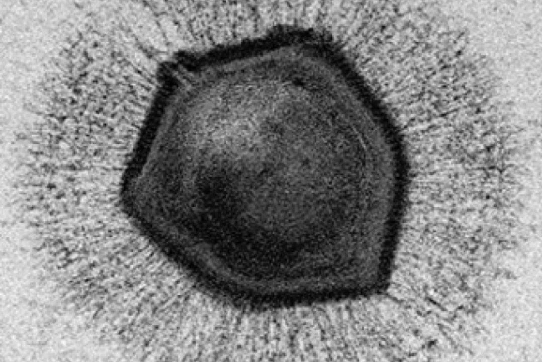 Гигантские вирусы мимивирусы. Самый большой вирус. Гигантский Сибирский вирус. Древние гигантские вирусы. Загадочный вирус
