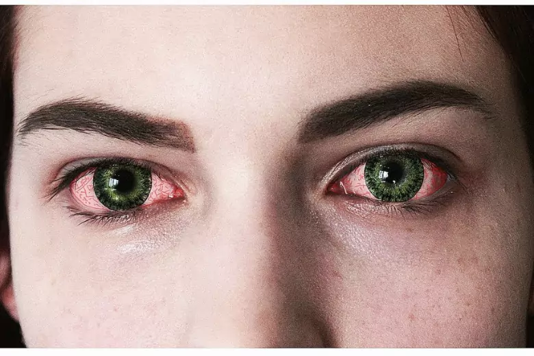 Можно в линзах спать час. Красные глаза у человека в реальной жизни. Покраснение глаз в линзах.
