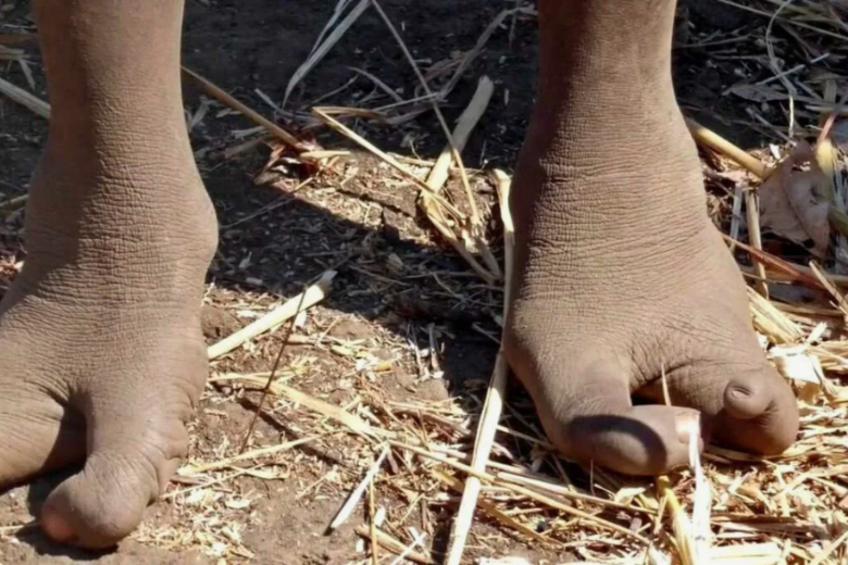 Люди с двумя пальцами на ногах: На самом севере Зимбабве есть особенное племя Вадома