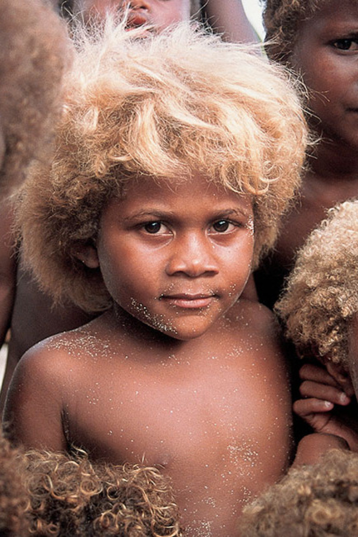 Примерно 10% темнокожих жителей Соломоновых островов, что расположены к северо-востоку от Австралии — блондины.