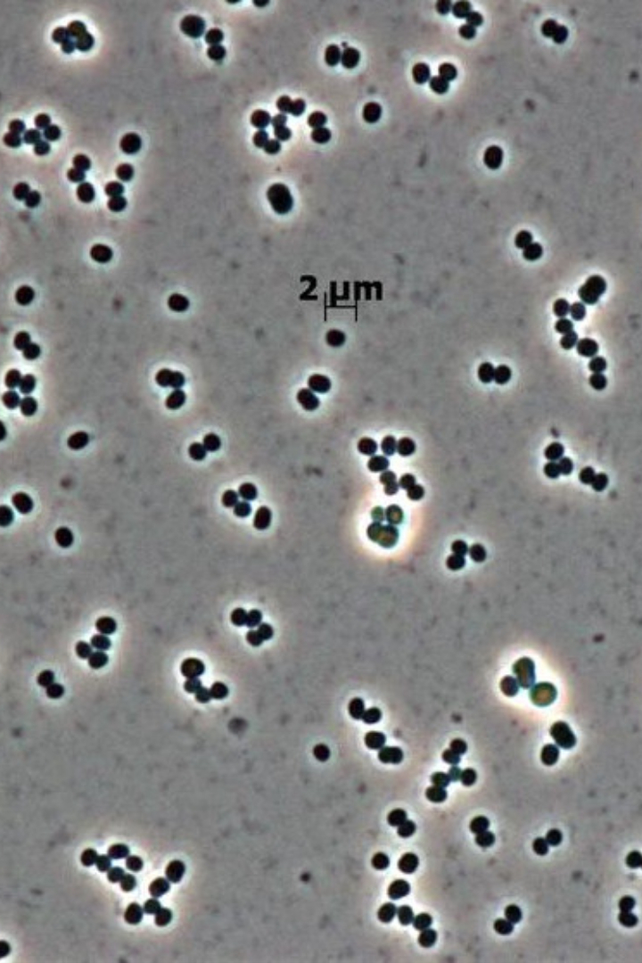 Бактерия Tersicoccus phoenicis была обнаружена в 2013 году в помещениях, где меньше всего её ожидали найти — стерильных комнатах НАСА и Европейского космического агентства. 