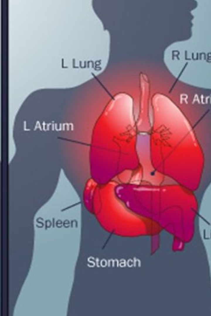 Примерно один из десяти тысяч человек рождается с зеркально отражённым расположением внутренних органов: сердце, желудок и селезёнка у него расположены справа, а печень и желчный пузырь — слева.