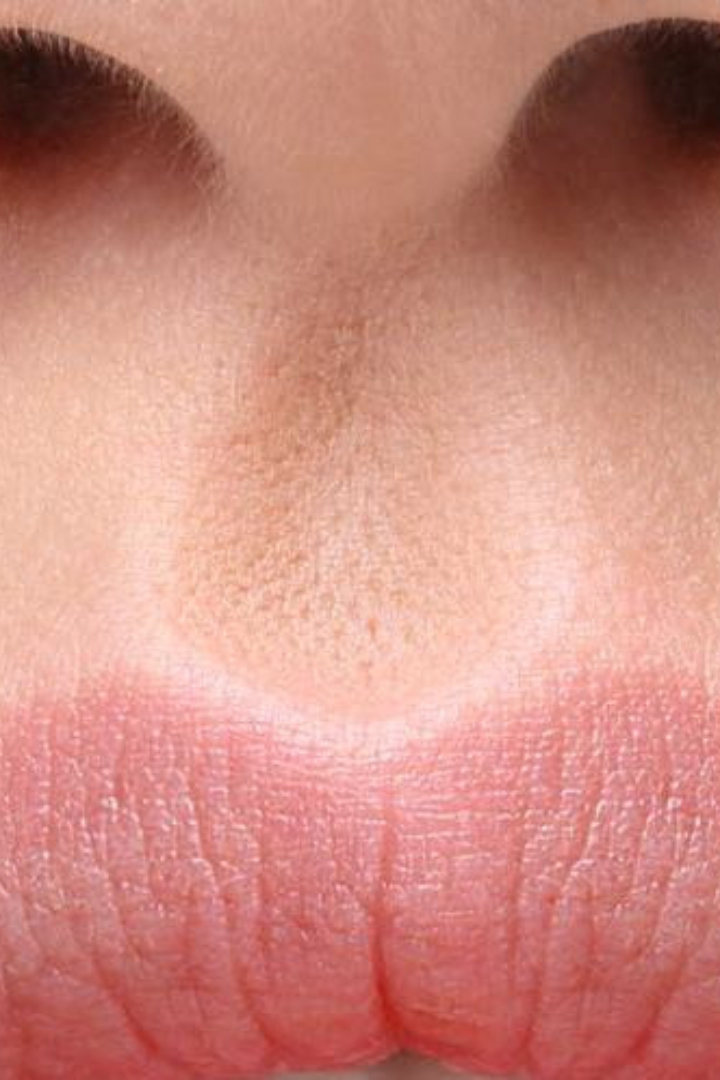 Складка кожи между носом и верхней губой называется губной желобок или, по-латински, фильтрум. 
