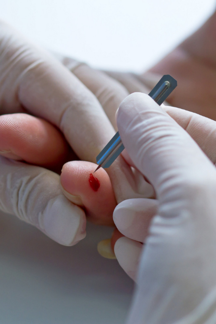 Кровь чаще всего берут из безымянного пальца потому, что, по сравнению с указательным и средним, он меньше используется в работе. 